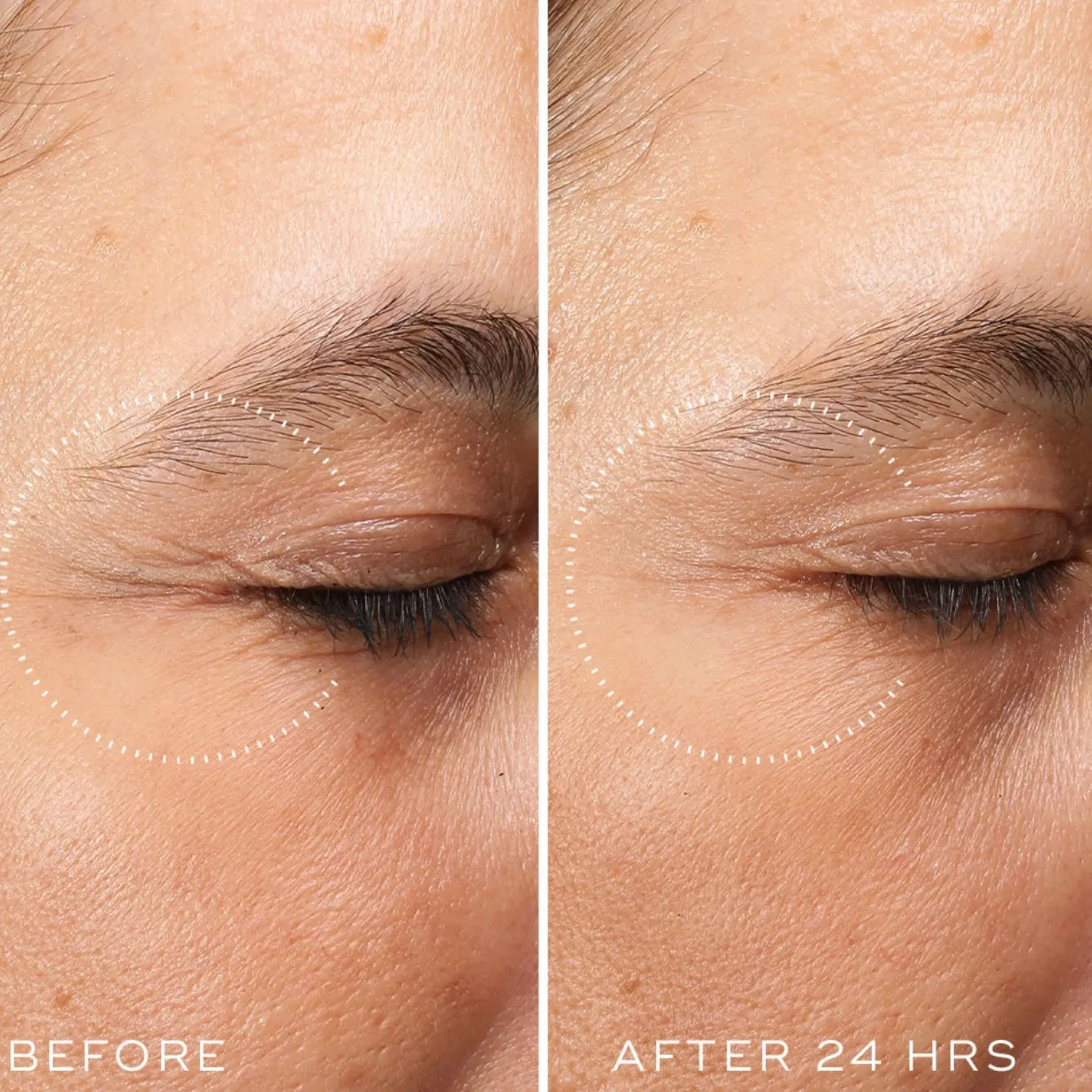 Crystal Retinal Ceramide Eye 10