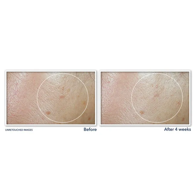 Roc MULTI CORREXION Even Tone   Lift Daily Moisturizer SPF 30